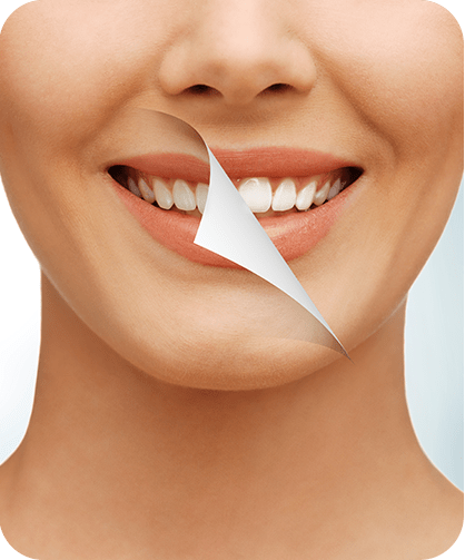 Teeth Whitening | Neighbourhood Dental | General & Family Dentist | Blackfalds, AB