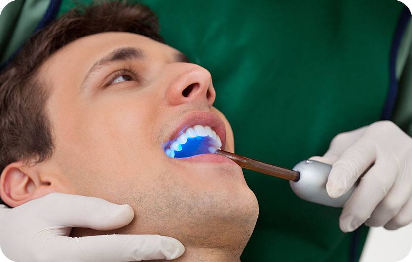Cosmetic Tooth Bonding | Neighbourhood Dental | General & Family Dentist | Blackfalds, AB