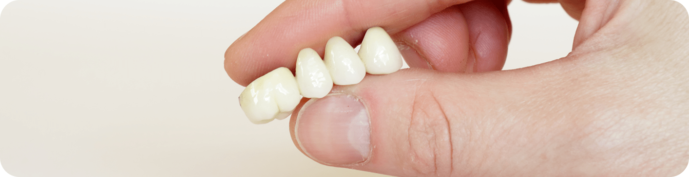 Dental Bridges | Neighbourhood Dental | General & Family Dentist | Blackfalds, AB