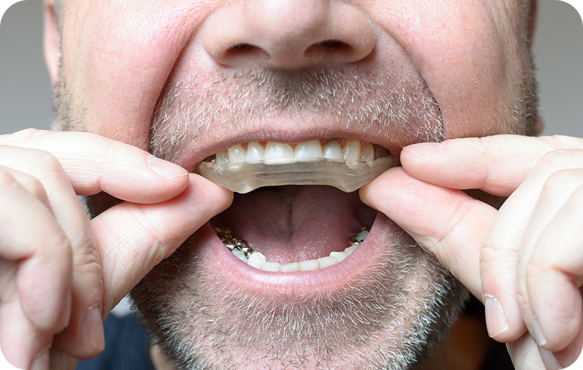 Orthodontic Dentistry | Neighbourhood Dental | General & Family Dentist | Blackfalds, AB