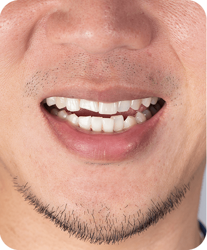Orthodontics | Neighbourhood Dental | General & Family Dentist | Blackfalds, AB