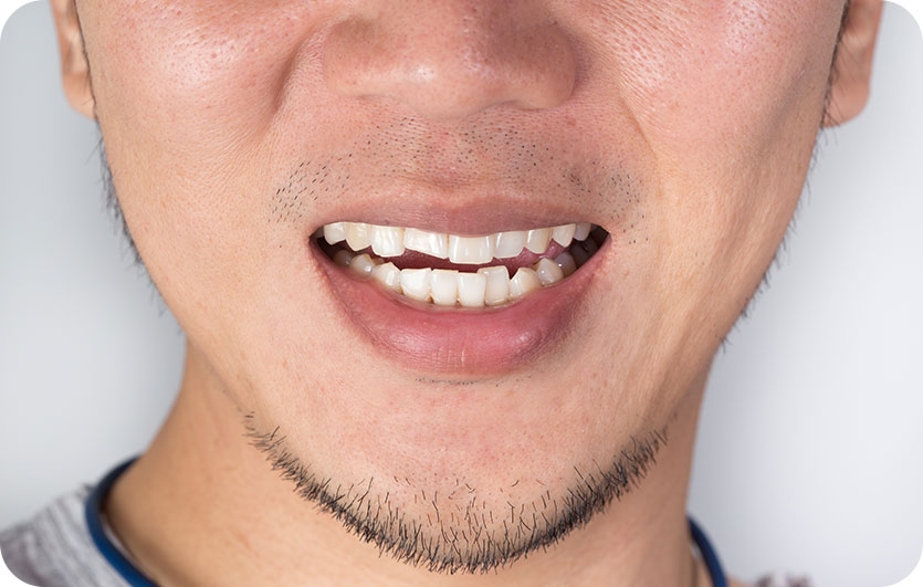Orthodontics | Neighbourhood Dental | General & Family Dentist | Blackfalds, AB