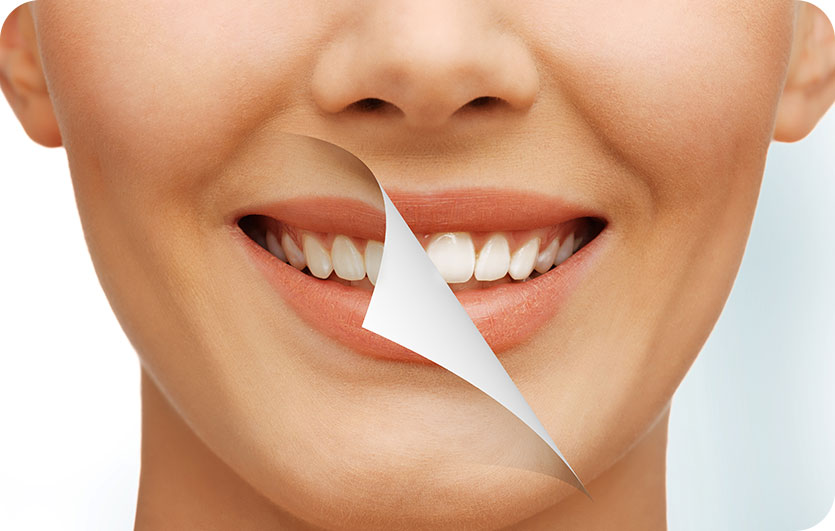 Teeth Whitening | Neighbourhood Dental | General & Family Dentist | Blackfalds, AB