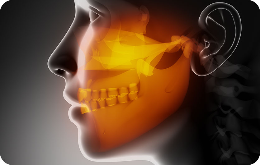 TMJ/TMD Therapy | Neighbourhood Dental | General & Family Dentist | Blackfalds, AB